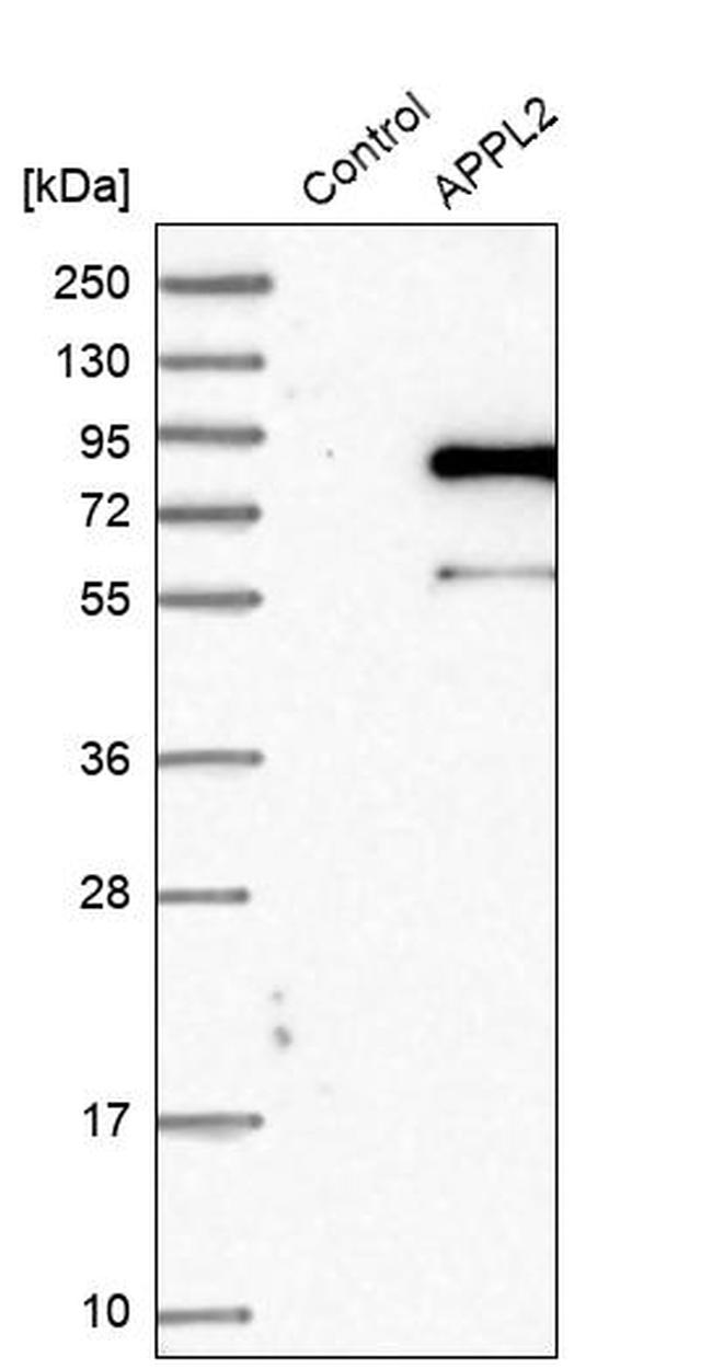 DIP13B Antibody in Western Blot (WB)