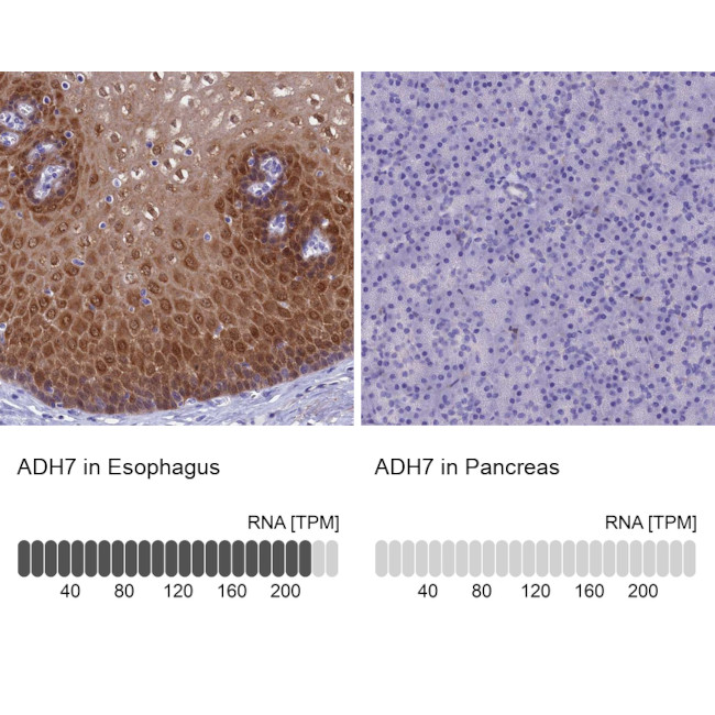 ADH7 Antibody in Immunohistochemistry (IHC)