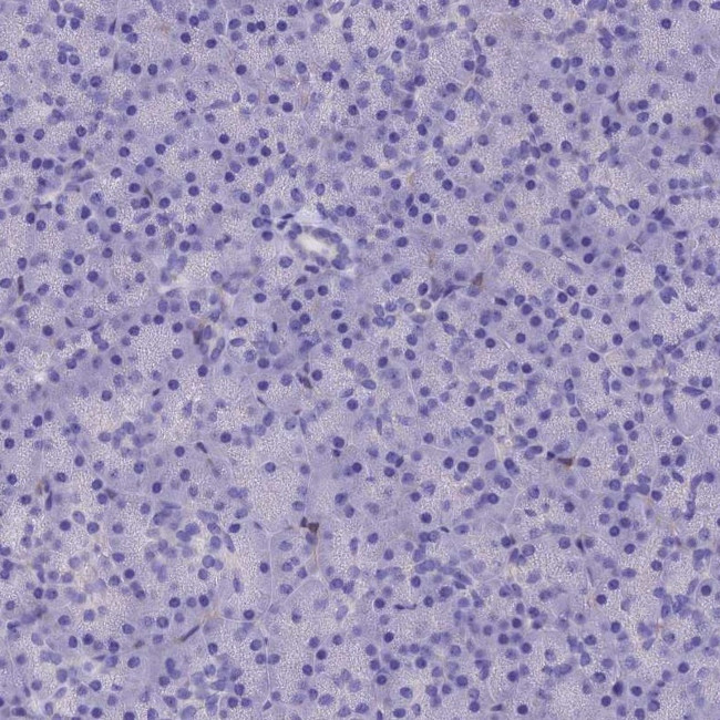 ADH7 Antibody in Immunohistochemistry (IHC)