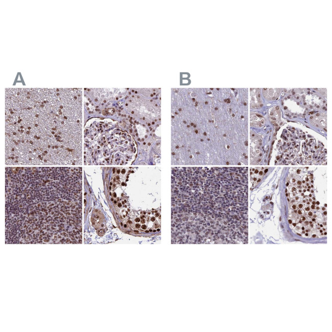 MPP8 Antibody in Immunohistochemistry (IHC)