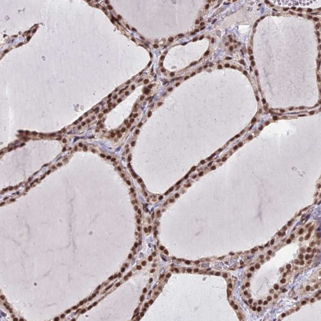 MPP8 Antibody in Immunohistochemistry (IHC)