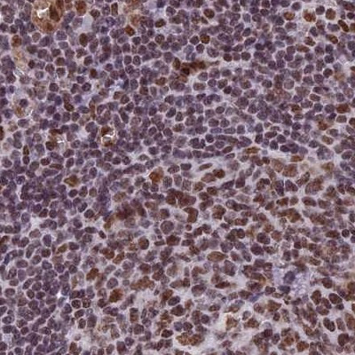 MPP8 Antibody in Immunohistochemistry (IHC)