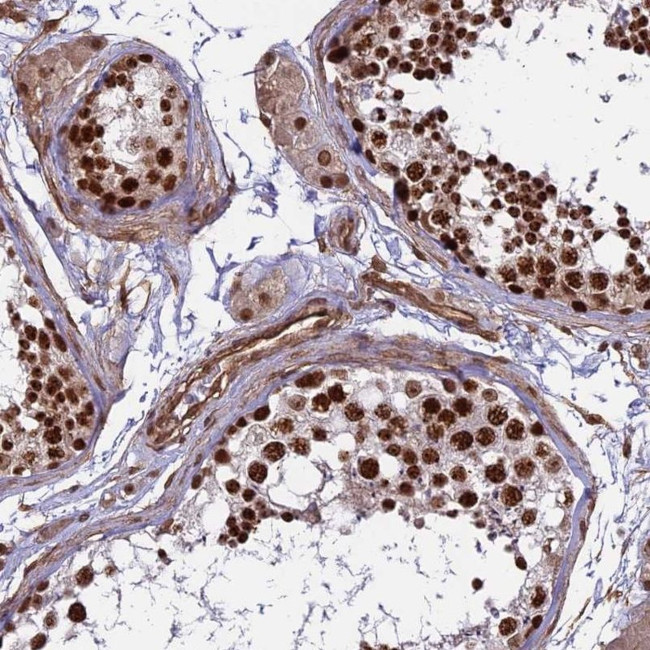 MPP8 Antibody in Immunohistochemistry (IHC)