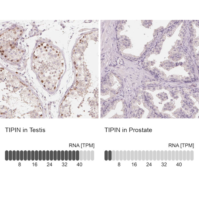 TIPIN Antibody in Immunohistochemistry (IHC)