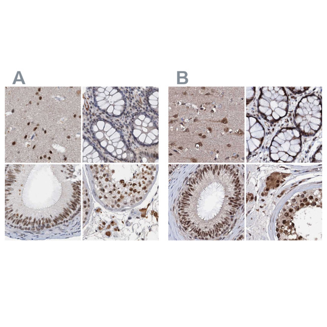 CSTF3 Antibody in Immunohistochemistry (IHC)