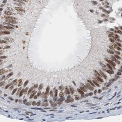 CSTF3 Antibody in Immunohistochemistry (IHC)