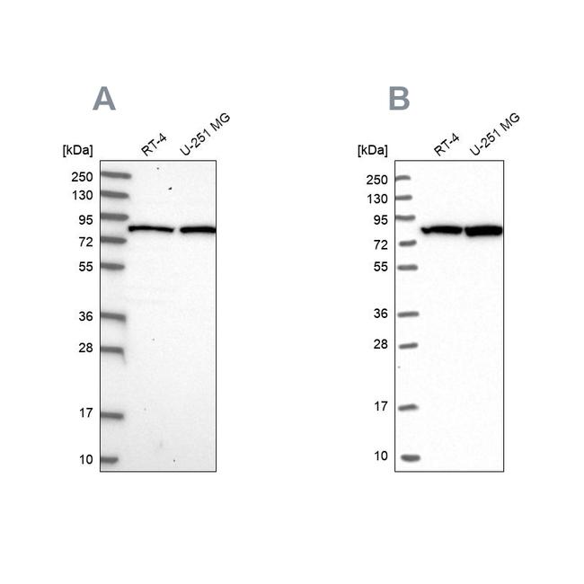 CSTF3 Antibody in Western Blot (WB)