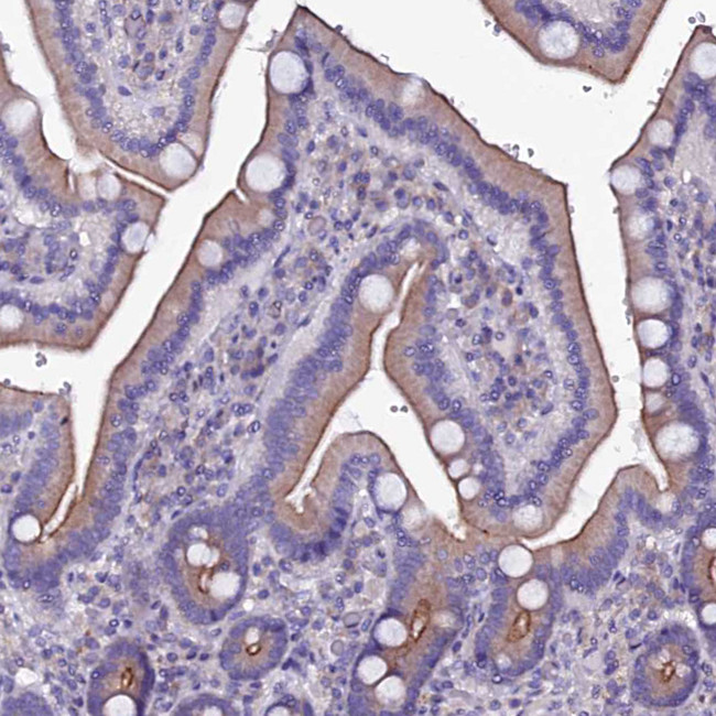 SELT Antibody in Immunohistochemistry (IHC)