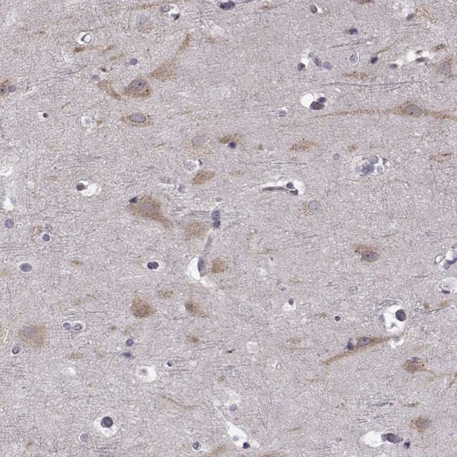 B3GNT6 Antibody in Immunohistochemistry (IHC)