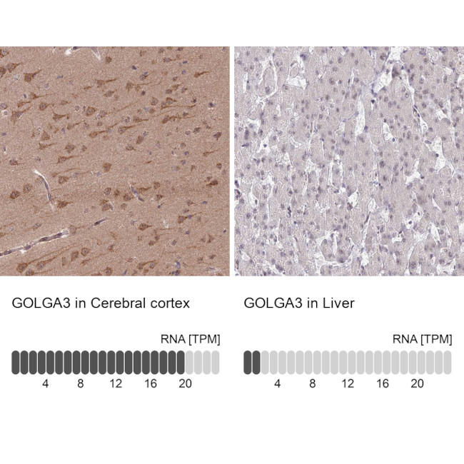 GOLGA3 Antibody in Immunohistochemistry (IHC)