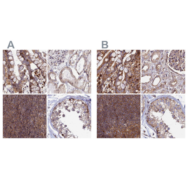 GOLGA3 Antibody in Immunohistochemistry (IHC)