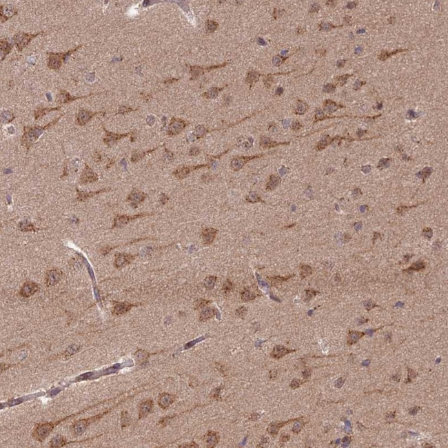 GOLGA3 Antibody in Immunohistochemistry (IHC)