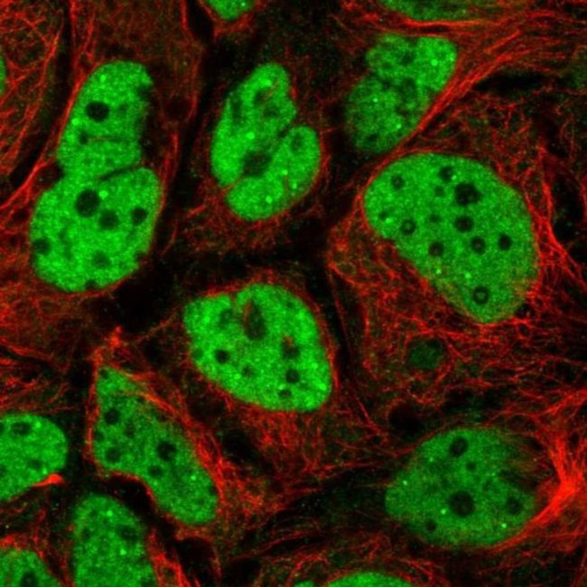 WHSC2 Antibody in Immunocytochemistry (ICC/IF)