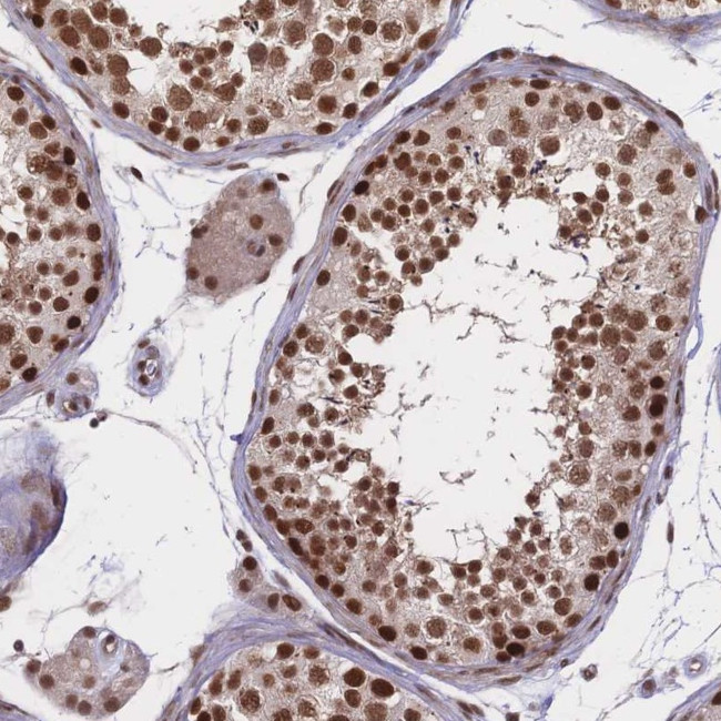 WHSC2 Antibody in Immunohistochemistry (IHC)