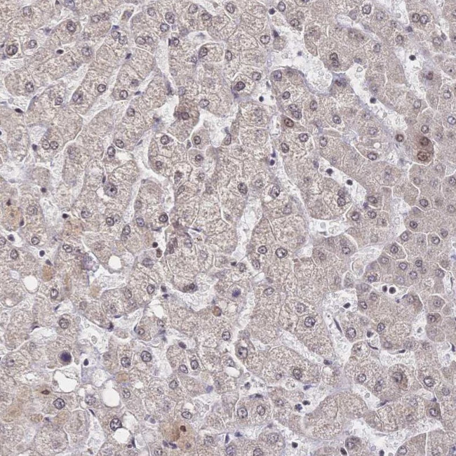 WHSC2 Antibody in Immunohistochemistry (IHC)