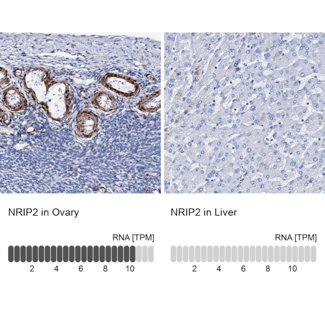 NRIP2 Antibody