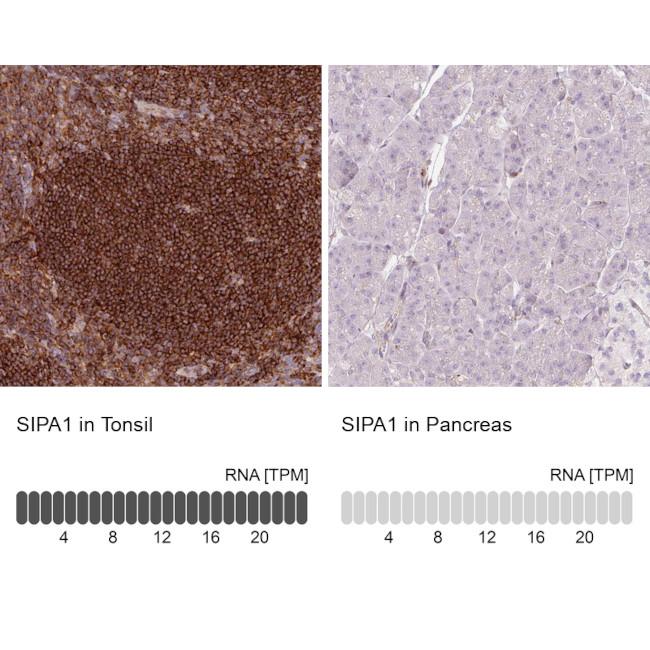 SIPA1 Antibody in Immunohistochemistry (IHC)