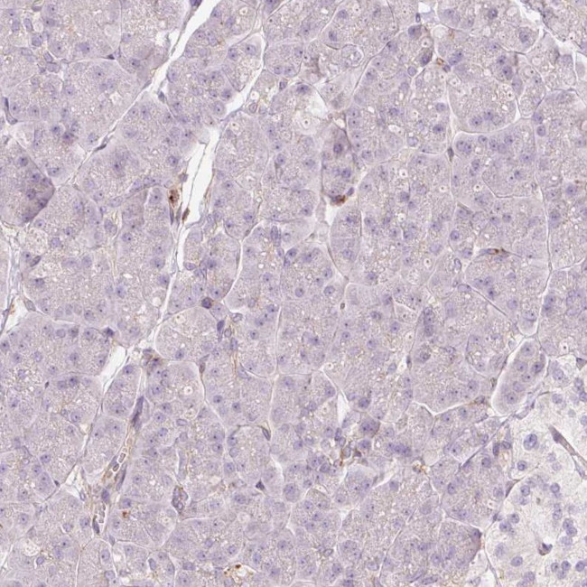 SIPA1 Antibody in Immunohistochemistry (IHC)