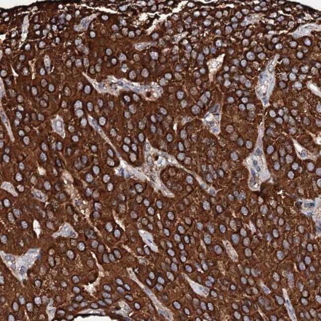 SECISBP2L Antibody in Immunohistochemistry (IHC)