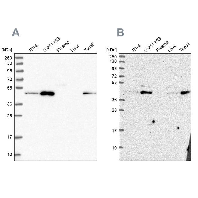 ZDHHC16 Antibody in Western Blot (WB)