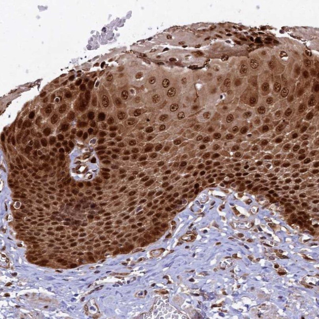 TGDS Antibody in Immunohistochemistry (IHC)