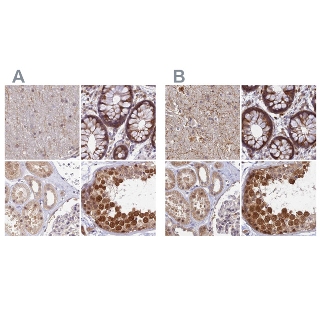 WDR61 Antibody in Immunohistochemistry (IHC)