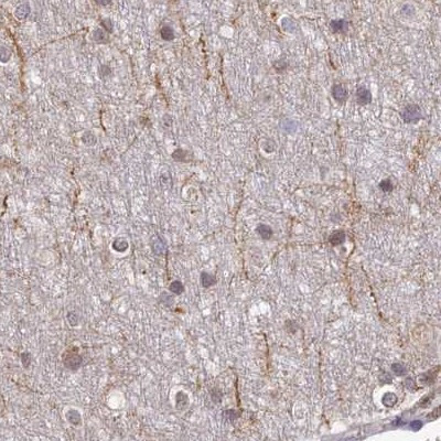 WDR61 Antibody in Immunohistochemistry (IHC)