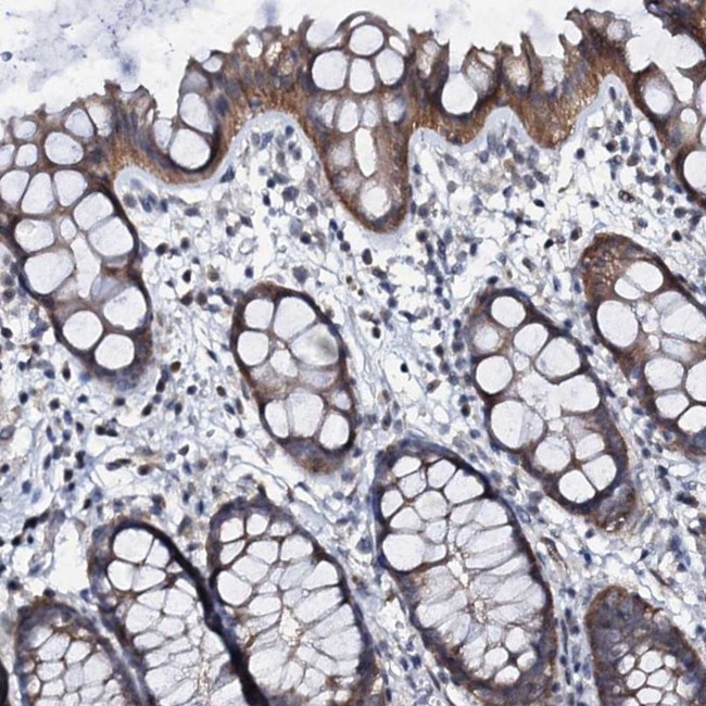 GPR176 Antibody in Immunohistochemistry (IHC)