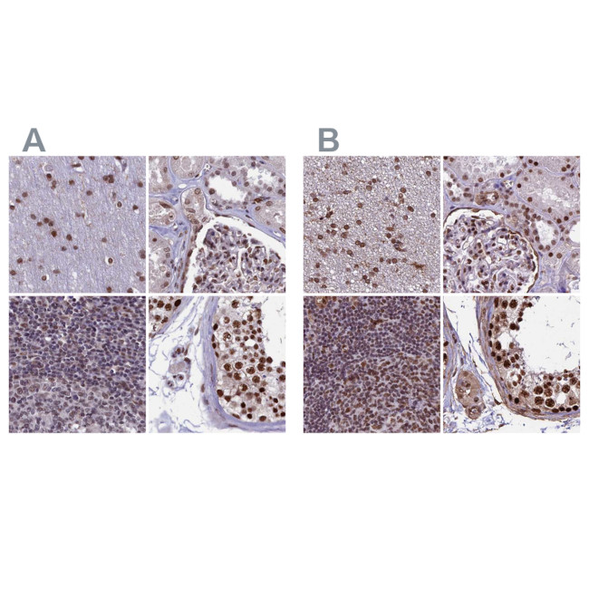 MPP8 Antibody in Immunohistochemistry (IHC)