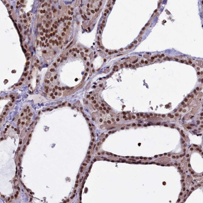 MPP8 Antibody in Immunohistochemistry (IHC)