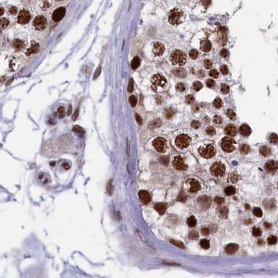 MPP8 Antibody in Immunohistochemistry (IHC)