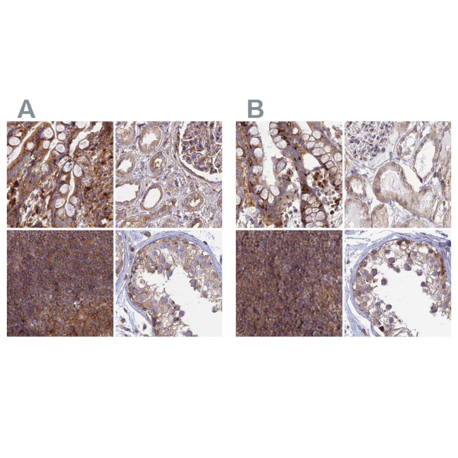 GOLGA3 Antibody in Immunohistochemistry (IHC)