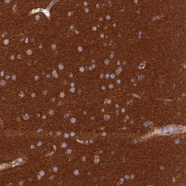 GOLGA3 Antibody in Immunohistochemistry (IHC)