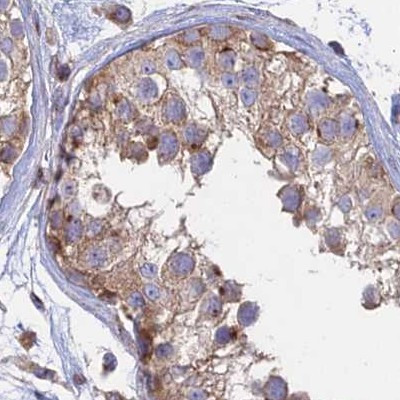 GOLGA3 Antibody in Immunohistochemistry (IHC)