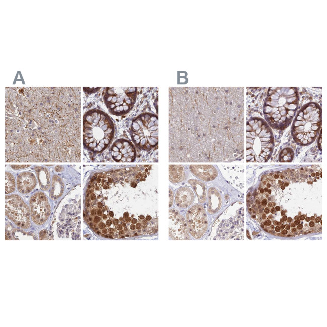 WDR61 Antibody in Immunohistochemistry (IHC)