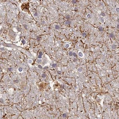 WDR61 Antibody in Immunohistochemistry (IHC)