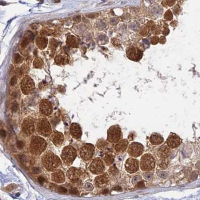 WDR61 Antibody in Immunohistochemistry (IHC)