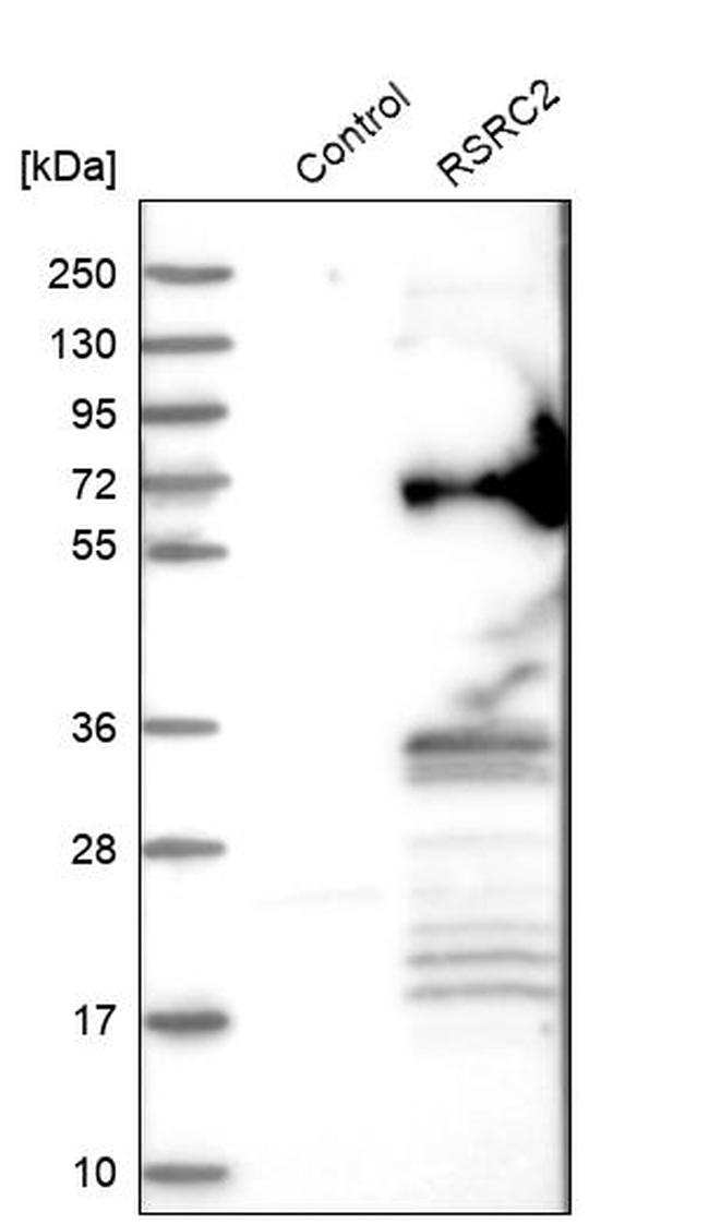 RSRC2 Antibody in Western Blot (WB)