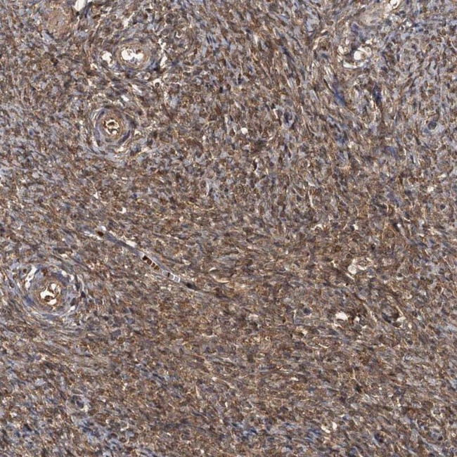 HYI Antibody in Immunohistochemistry (IHC)