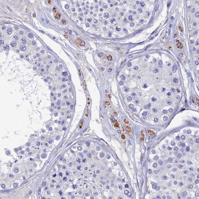 OAT Antibody in Immunohistochemistry (IHC)