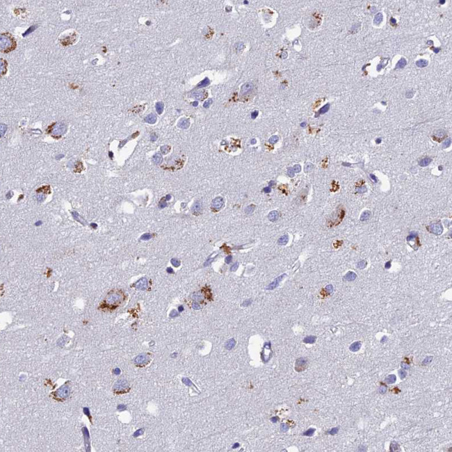 OAT Antibody in Immunohistochemistry (IHC)