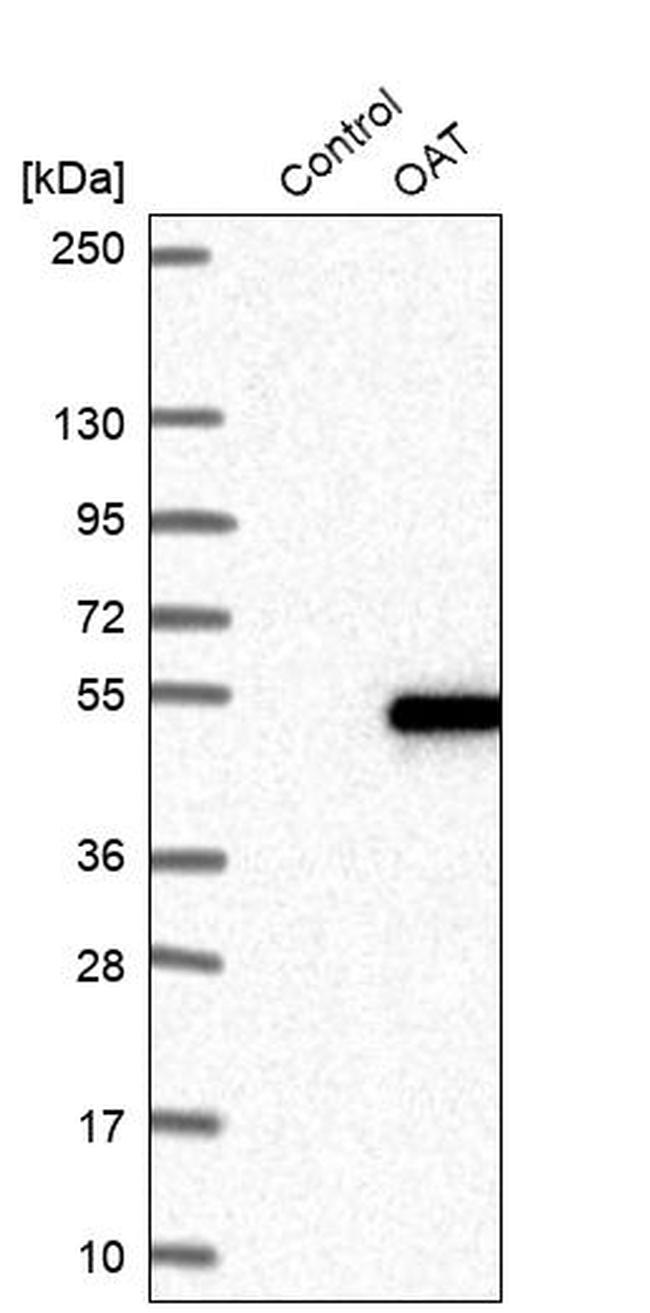 OAT Antibody in Western Blot (WB)