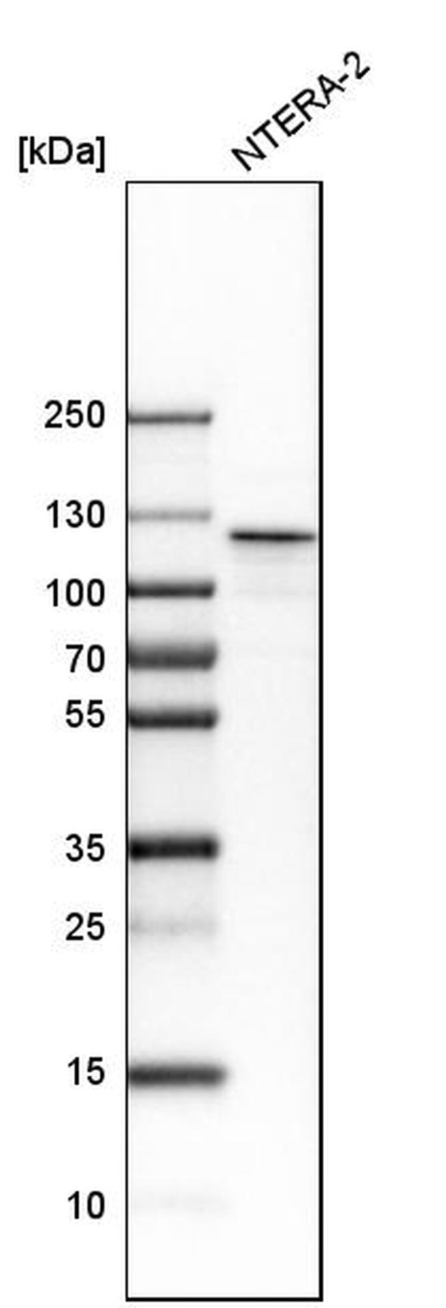 NOP2 Antibody in Western Blot (WB)