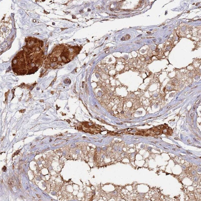 LACC1 Antibody in Immunohistochemistry (IHC)