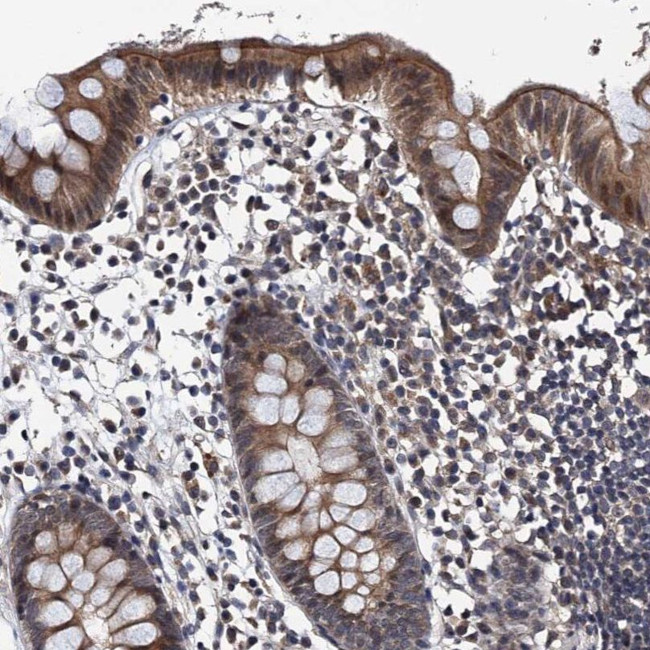 NAA16 Antibody in Immunohistochemistry (IHC)