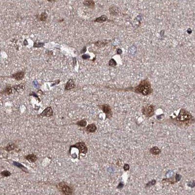 CSTF3 Antibody in Immunohistochemistry (IHC)