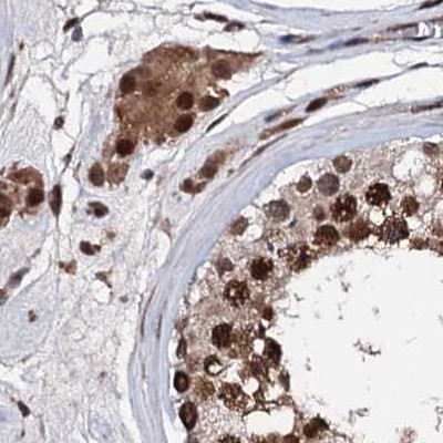 CSTF3 Antibody in Immunohistochemistry (IHC)