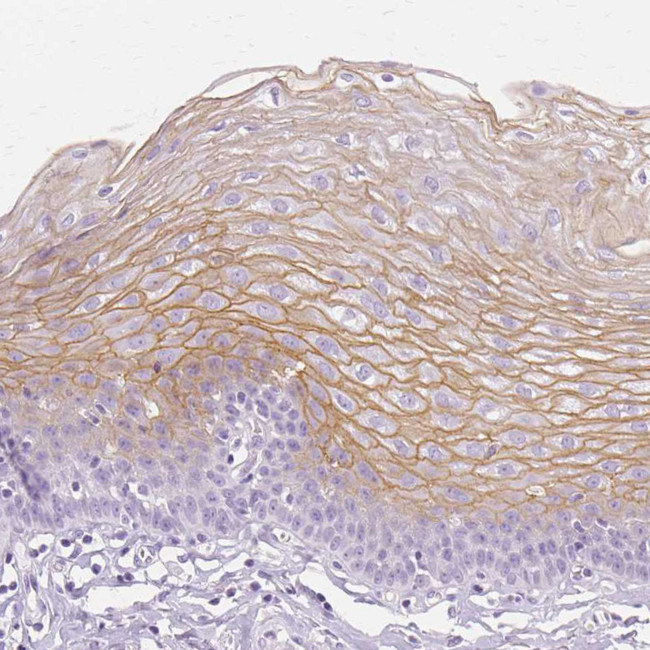 TGM1 Antibody in Immunohistochemistry (IHC)