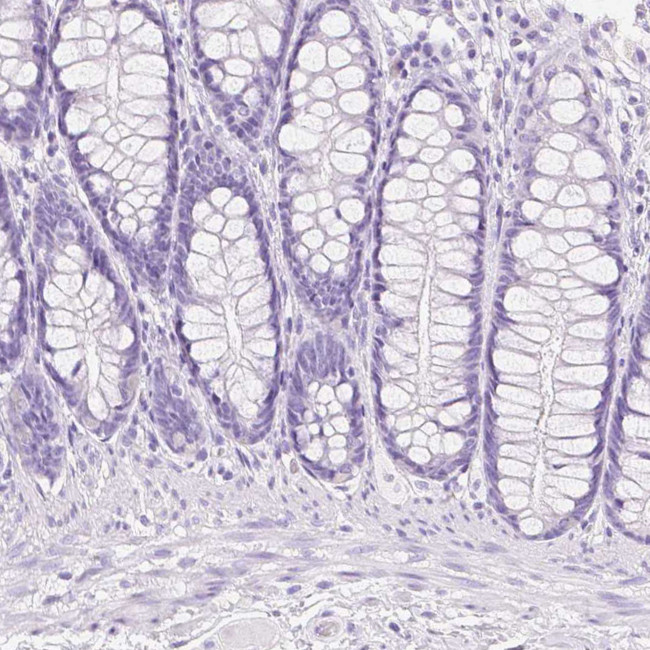 TGM1 Antibody in Immunohistochemistry (IHC)