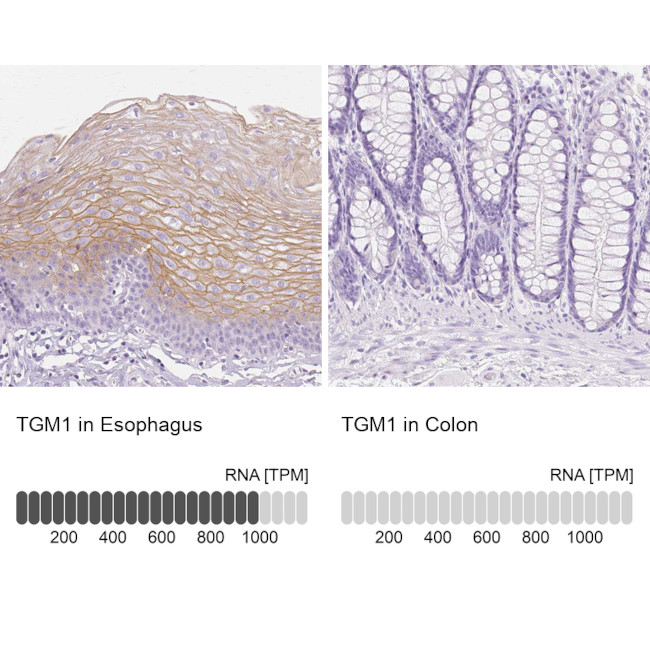 TGM1 Antibody